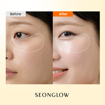SEONGLOW Caffeine &amp; Niacinamide Eye Gel Patch 30Pairs