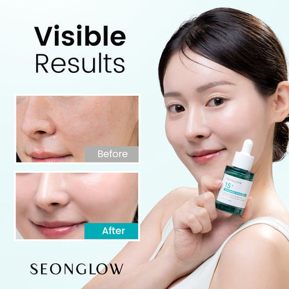 SEONGLOW 15% Vegan Niacinamide+ 3% Tranexamic Acid Serum: Korean Skin Care Niacinamide serum - Pore Minimizer for Face, Glutathione, Zinc PCA, 1.01 fl.oz.(30ml)